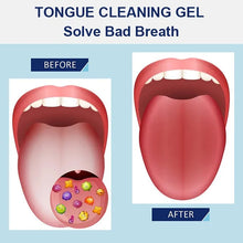 Load image into Gallery viewer, ✨Tongue Cleaning Gel Set👅
