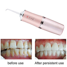 Load image into Gallery viewer, Portable Dental Water Flosser
